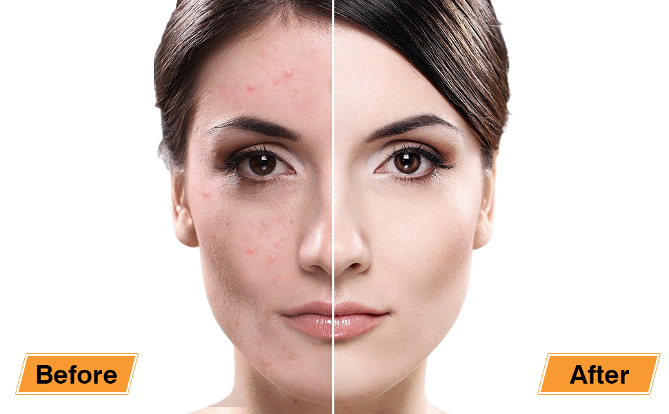 La dulce combinación de miel y azúcar para un rostro radiante La dulce combinación de miel y azúcar para un rostro radiante